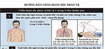 4 Mức Độ Của Sốc Phản Vệ